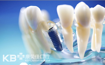 沈阳如何延长种植牙的寿命