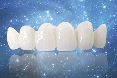 烤瓷牙